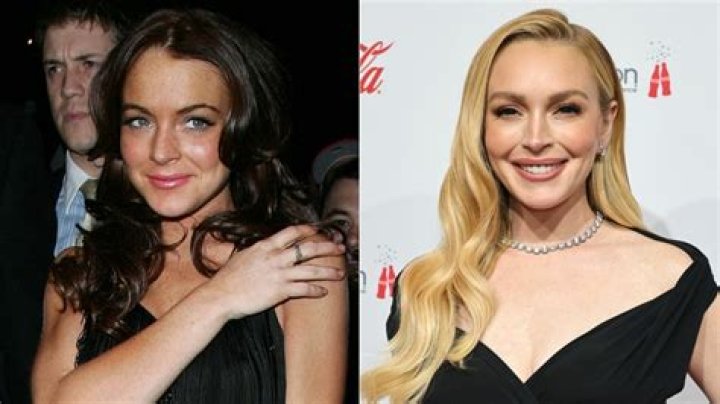 Did Lindsay get Botox?