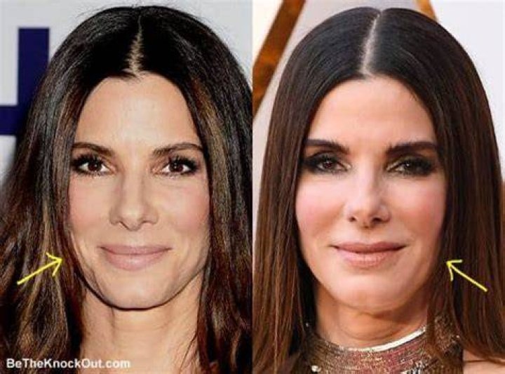 Did Sandra Bullock do a recent “plastic surgery makeover”?