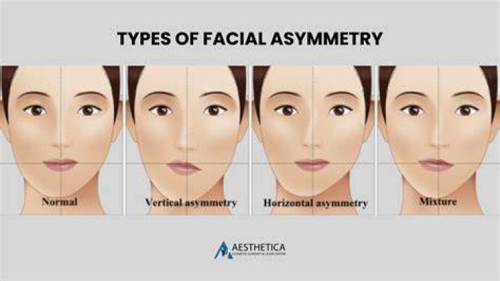 What does gaze asymmetry mean?