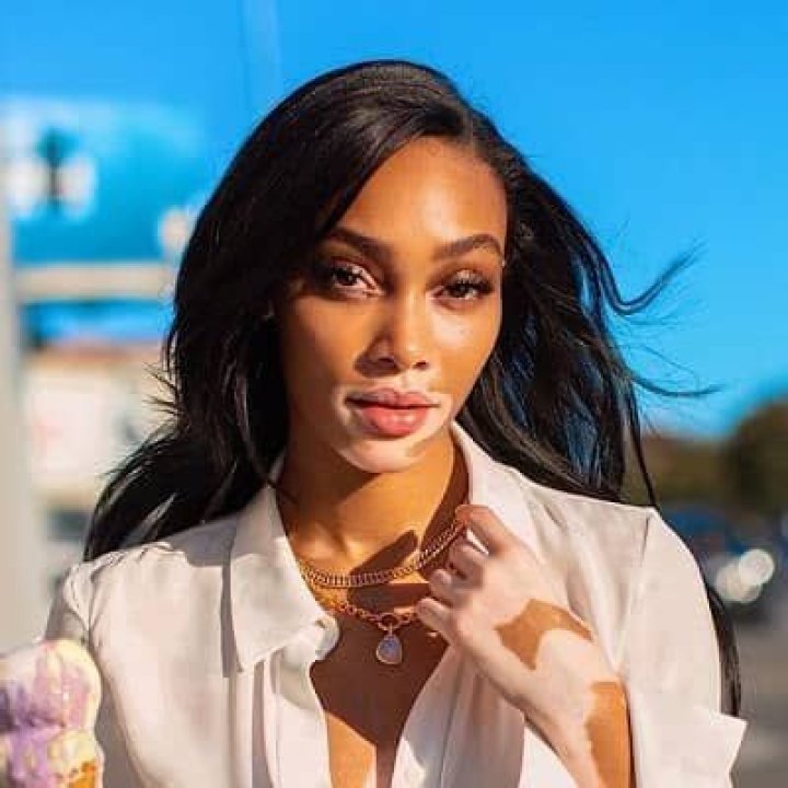 Winnie Harlow Bio (Wiki) 