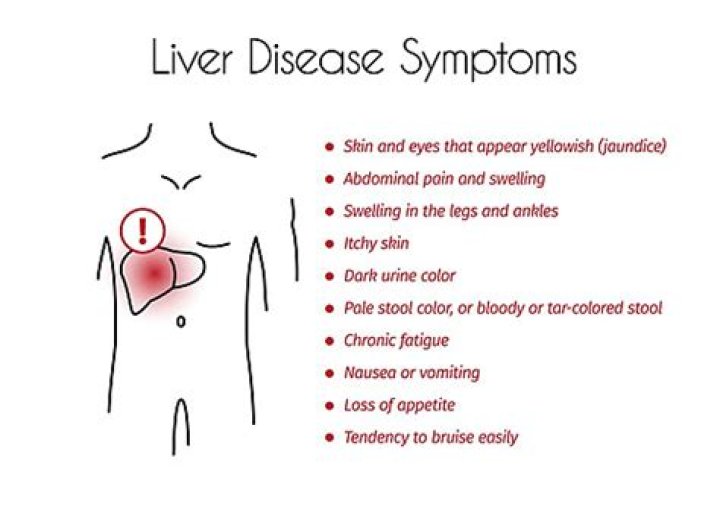 Young MA Liver Disease
